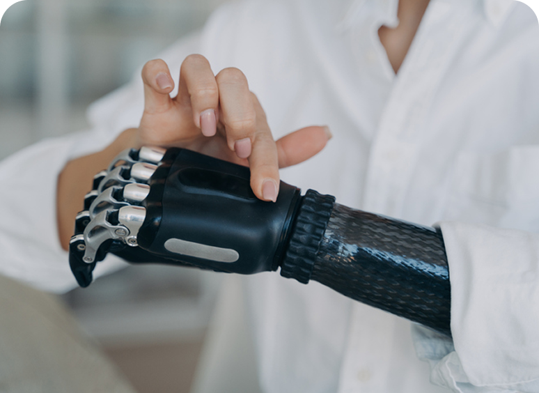 Person adjusting a black prosthetic arm.