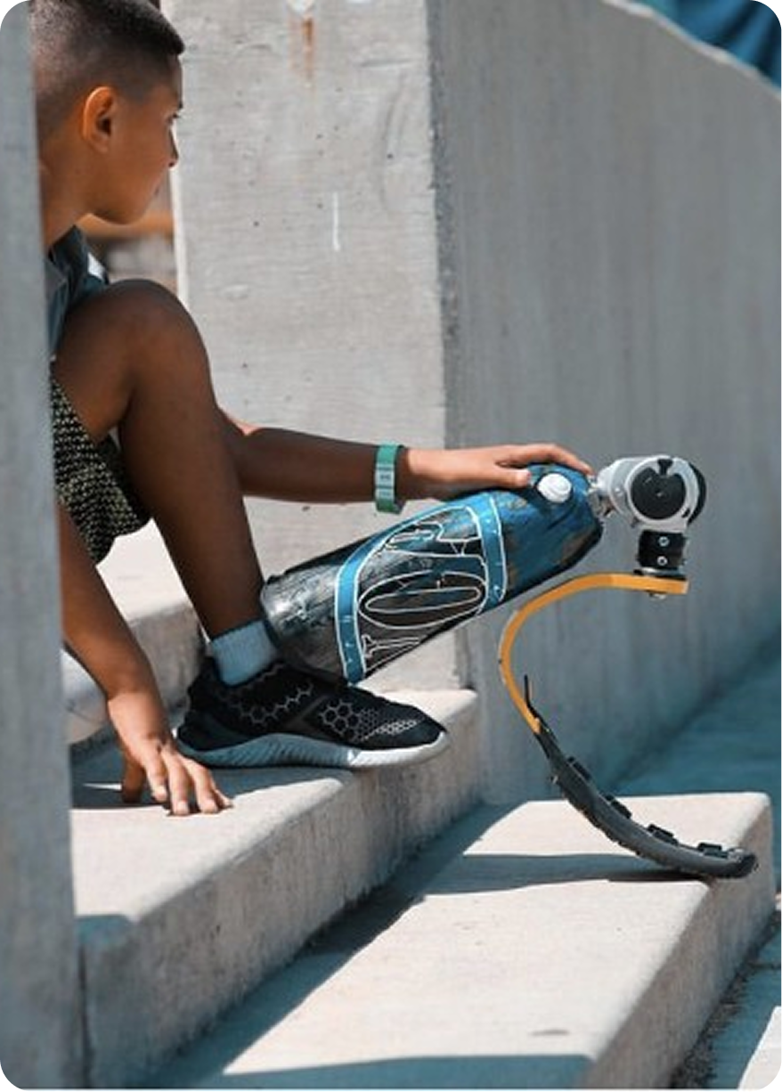 Boy with prosthetic leg sitting on steps.