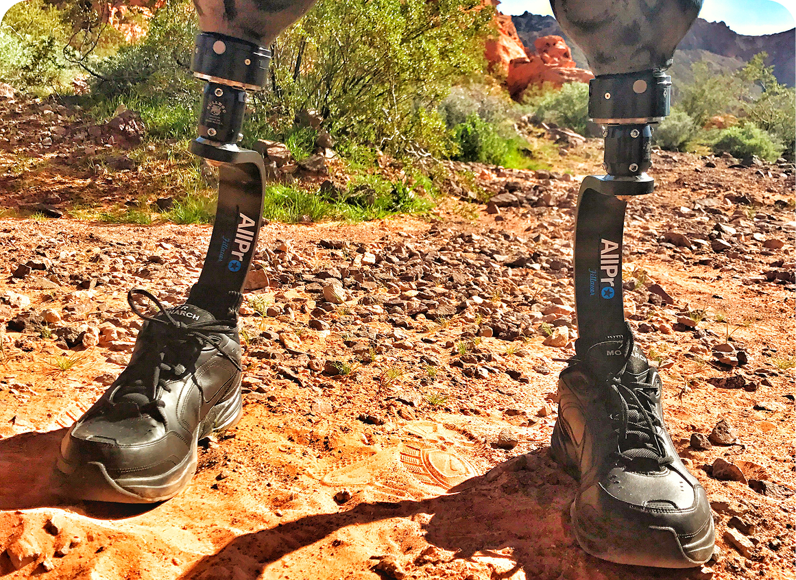 Prosthetic legs on rocky outdoor terrain.