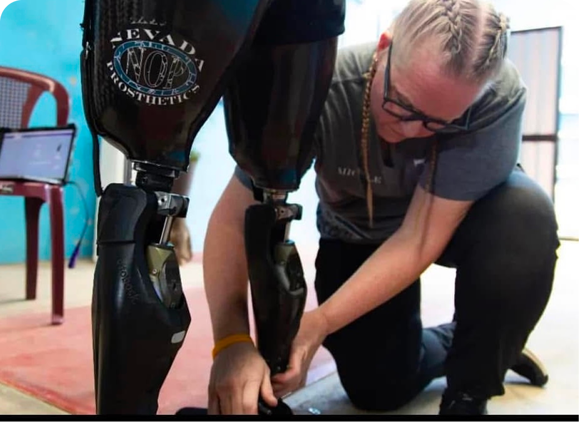 Person adjusting prosthetic legs on another individual.